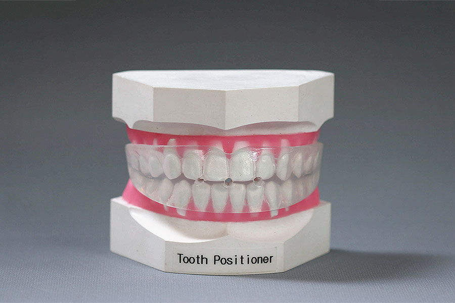 Tooth Positioner STAALAB