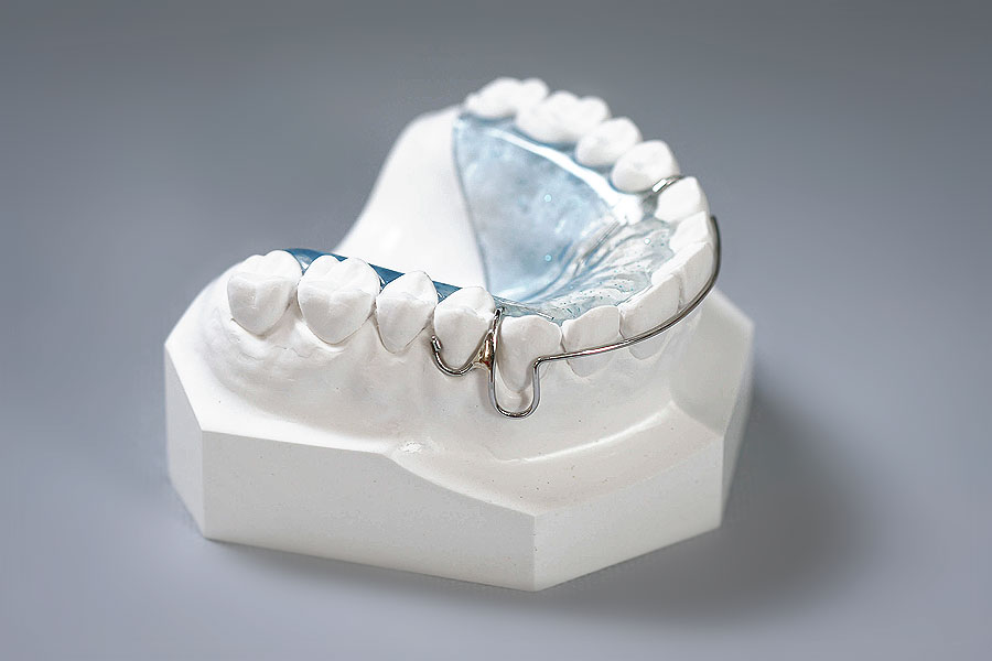 MOD Retainer C clasp solder STAALAB