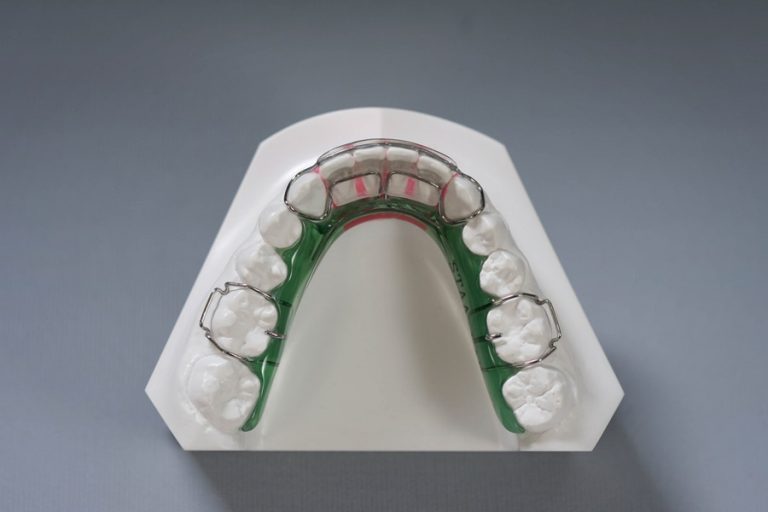 Spring Leg Retainer Spring with Hawley Retainer – STAALAB